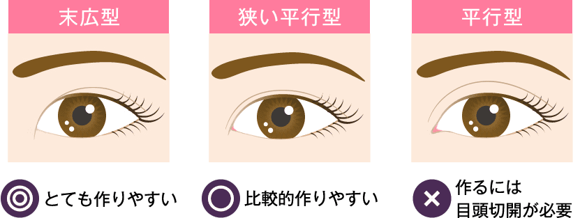 50〜80%以上涙丘が見える方の二重まぶたの種類別の作りやすさ