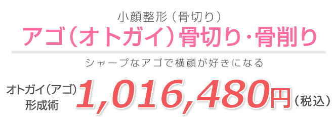 セットバック(お口元の小顔整形(骨切り))