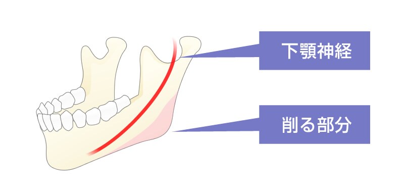 この神経を傷つけないようデザインを行います。