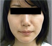 症例写真