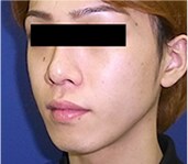 症例写真