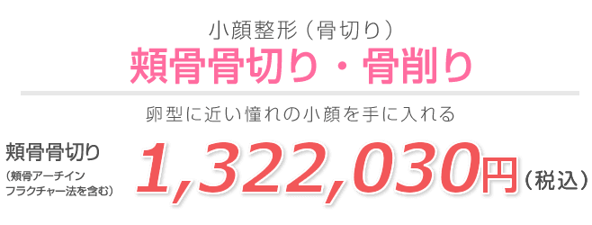 頬骨骨切り・骨削り(アーチ・インフラクチャー法)
