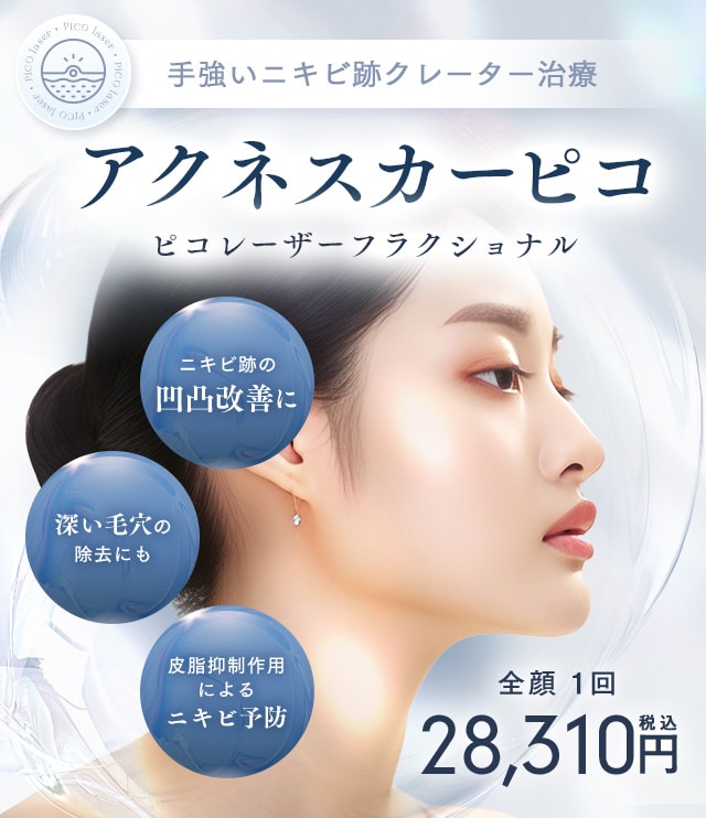 アクネスカーピコ
