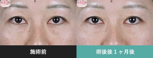 症例写真4