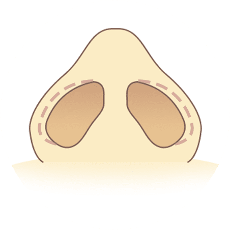 縫合