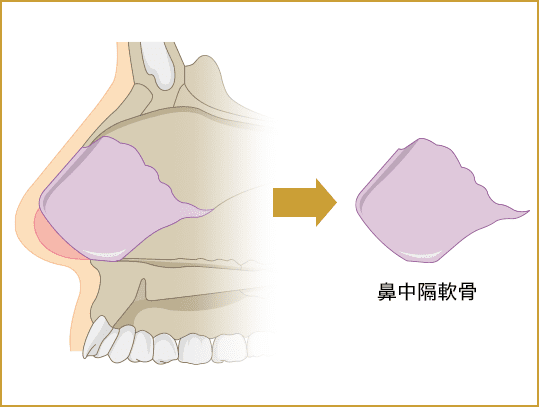 鼻中隔軟骨