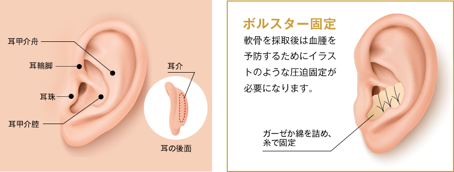 耳介軟骨