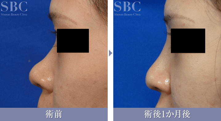 プロテーゼの症例写真{症例84701}