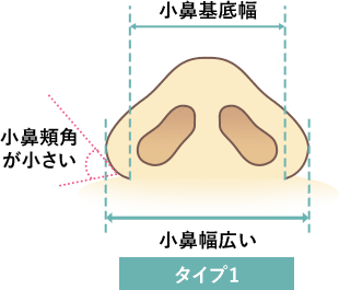 タイプ1