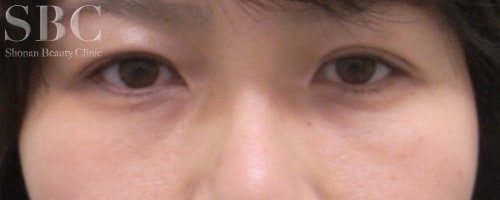 症例写真