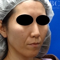 症例写真