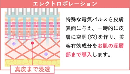 エレクトロポレーション イメージ3