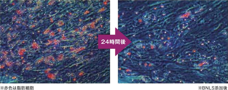BNLS neo 脂肪細胞反応実験