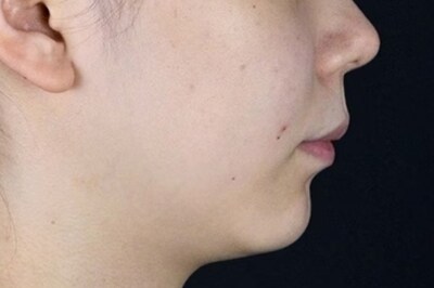 Before