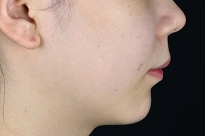 After