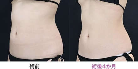 症例写真 画像01