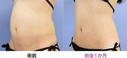 症例写真 画像04