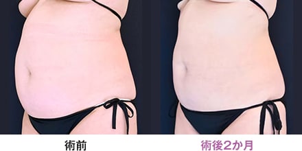 症例写真 画像05
