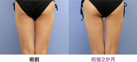 症例写真 画像06