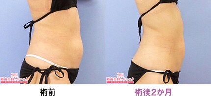 ピックアップ症例写真06