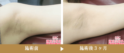症例写真145640
