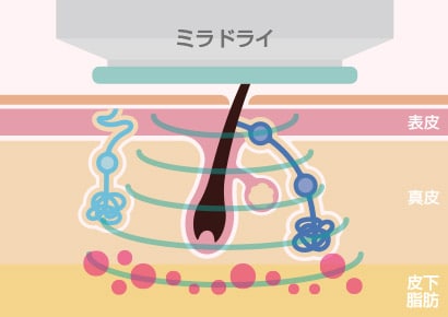 仕組み.1