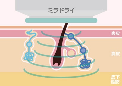 仕組み.2
