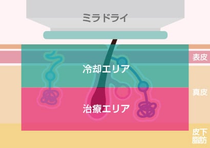 仕組み.3
