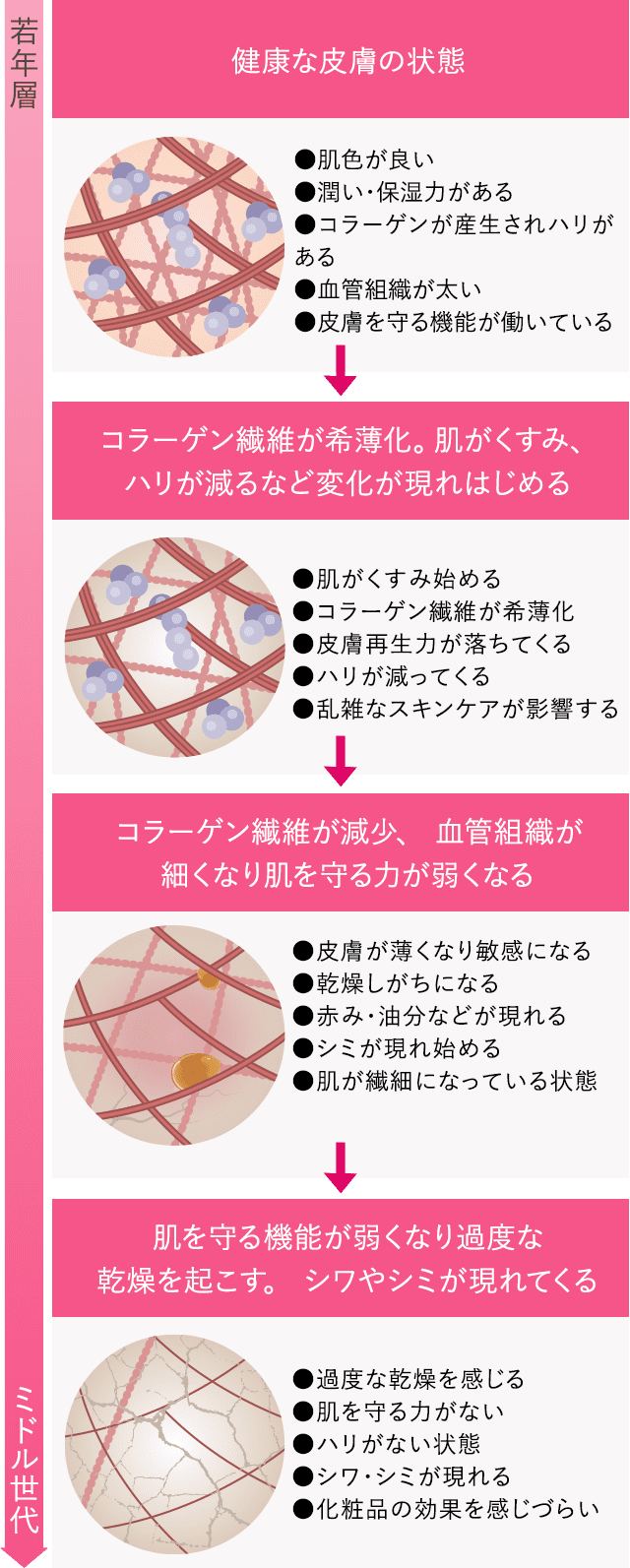 シミ・しわの原因
