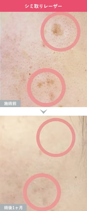 症例写真1