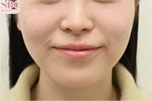 症例写真