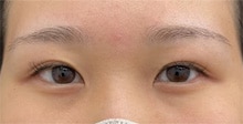 症例写真