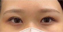 症例写真